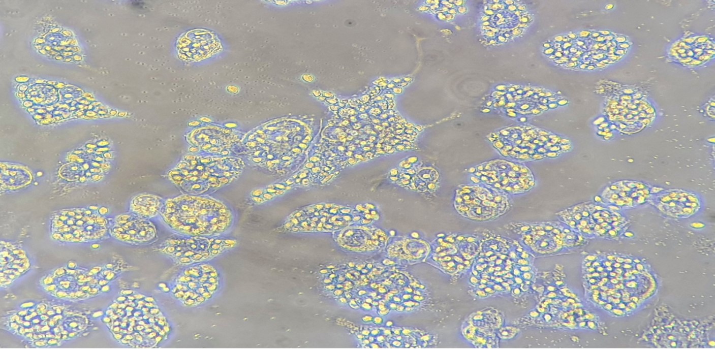 Phagocytosis of Yeasts by LPS - Stimulated Macrophages