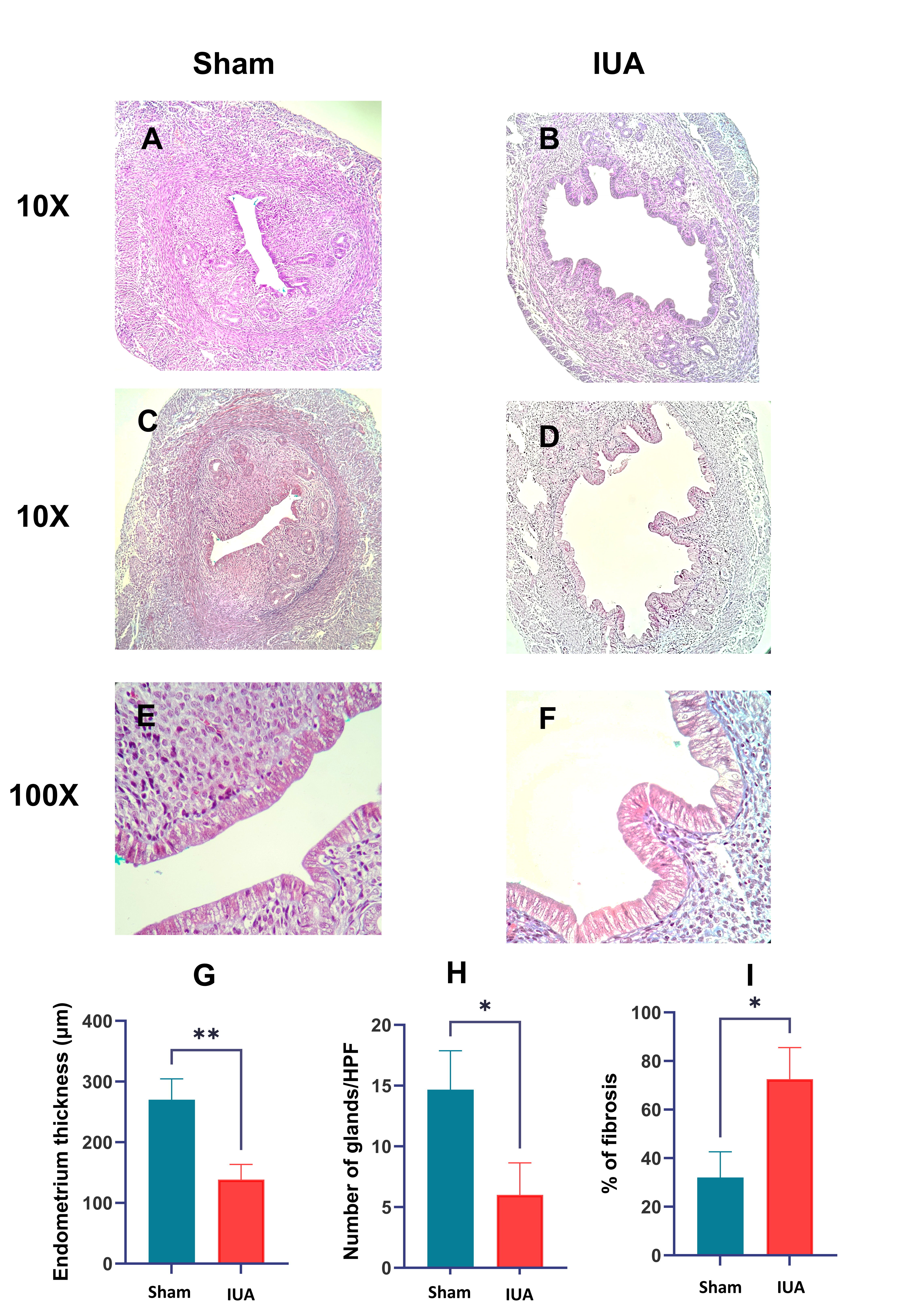 Histopathological analysis of the uterus in sham and IUA mice